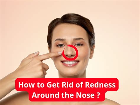 How To Get Rid Of Redness Around The Nose