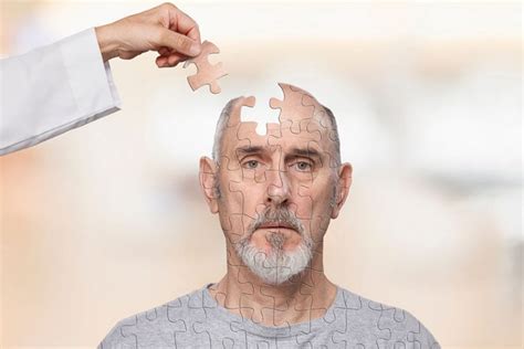Choroba Alzheimera Objawy Przyczyny Leczenie