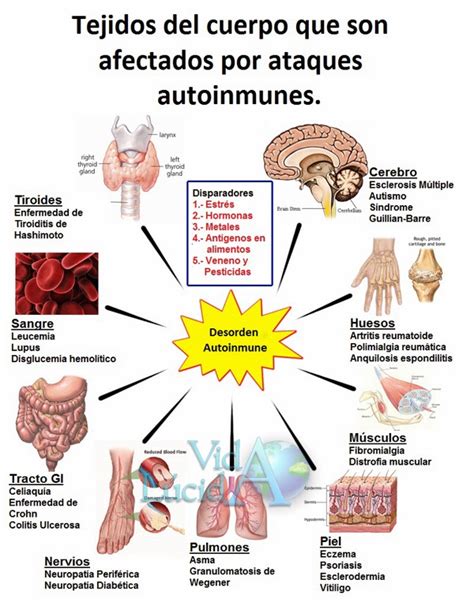 Signos De Una Enfermedad Autoinmune Y Cómo Revertirla