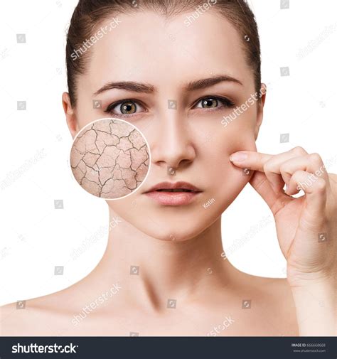 Zoom Circle Shows Facial Skin Before Stock Photo 666668668 Shutterstock
