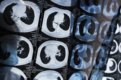 Unlike chinese internet companies that generally get good press, the country's pharmaceutical makers often seem to be in the news only when the china national pharmaceutical industry information center earlier this month posted a list of the industry's largest businesses ranked . New lung cancer drug can prolong lives of late-stage patients, study led by Hong Kong expert ...