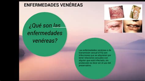 Enfermedades VenÉreas By Scarleth Palma