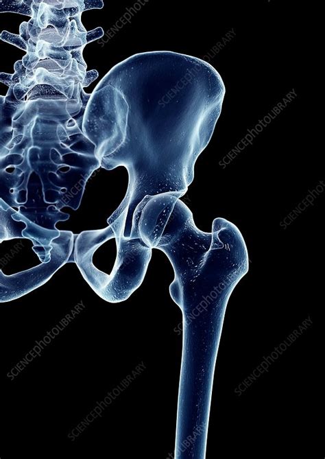 Human Hip Joint Stock Image F0163288 Science Photo Library