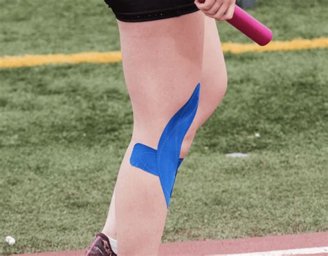KT Tape For Hypermobility And Ehlers Danlos Syndrome The Fibro Guy
