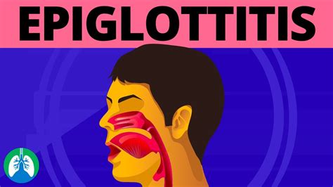 What Is Epiglottitis Medical Definition Youtube