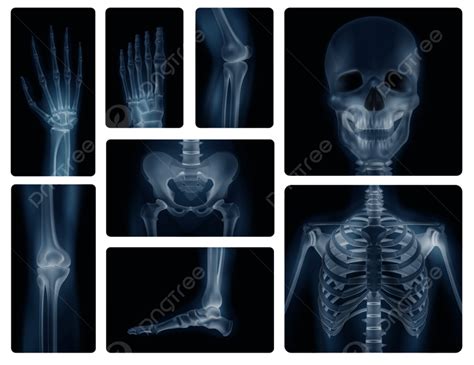 Human Limbs Vector Art Png Realistic X Ray Shots Of Human Bones Of