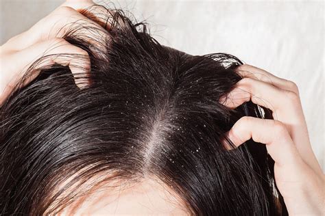 Greasy Hair Surprising Causes Behind Oily Locks Readers Digest