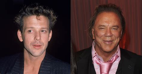 mickey rourke plastic surgery disasters purple clover