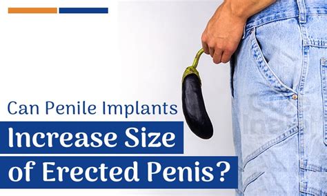Can Penile Implants Increase Size Debunking The Myth