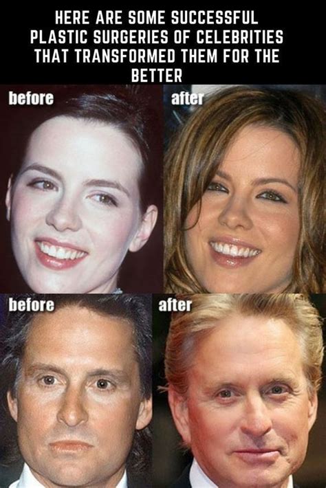 Check Out The Plastic Surgeries Of Celebrities That Proved Successful Plastic Surgeries