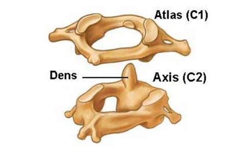 The vertebral foramen begins at cervical vertebra #1 (c1 or atlas) and continues inferior to lumbar all the vertebrae in front of the sacrum bore ribs except for the atlas and the last dorsal vertebra. A diagram depicting the Atlas and Axis vertebra of the ...