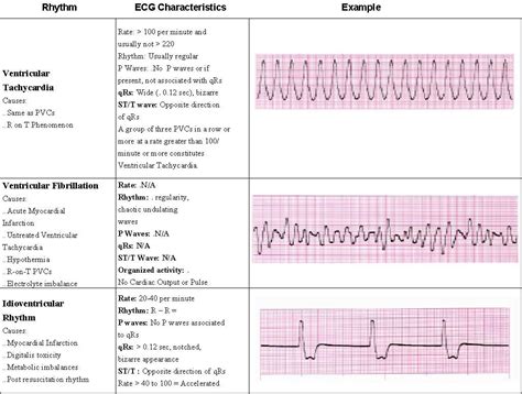 Acls Cheat Sheet Printables Hot Sex Picture