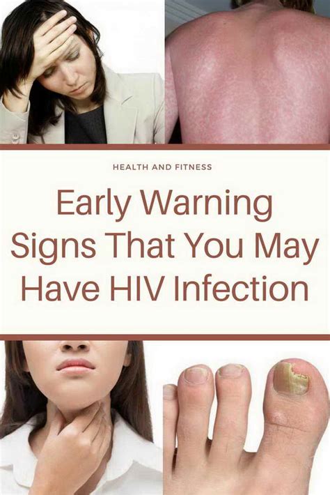 Early Warning Signs That You May Have Hiv Infection