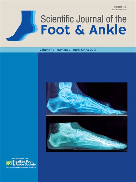 Correction Of Pediatric Flexible Flatfoot Using Arthroereisis Scientific Journal Of The Foot