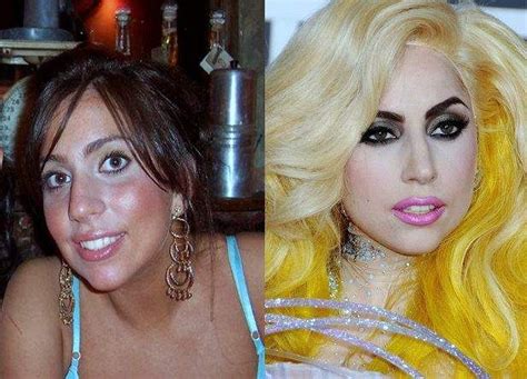 Lady Gaga Plastic Surgery Before And After Photos Lady Gaga Plastic
