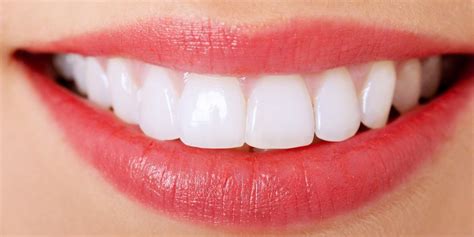 Porcelain Veneers Can Completely Reshape Your Teeth And Smile In West