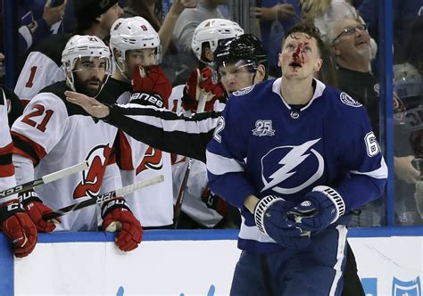 Andrej Sustr Shared A Gruesome Photo Of Cut On His Face Following Fight