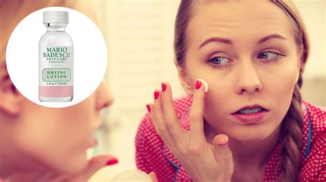 This Mario Badescu Drying Lotion makes pimples disappear overnight. Try