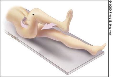 Appendicitis is an inflammation or infection of the appendix. Abdomen at Austin Peay State University - StudyBlue