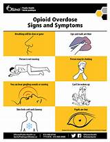 Images of Marijuana Overdose Symptoms