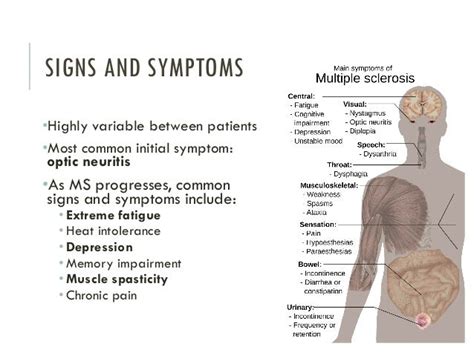 Multiple Sclerosis Symptoms The Unusual Symptoms Of Multiple