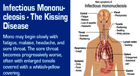 Treatment For Mono Philadelphia Holistic Clinic Dr Tsan And Associates