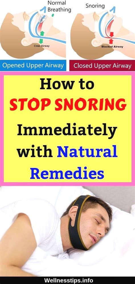 Pin By Larsimp On Health How To Stop Snoring Snoring Home Remedies