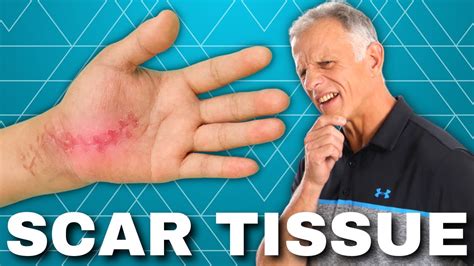 How To Get Rid Of Scar Tissue After Surgery Or Injury Hardened Youtube