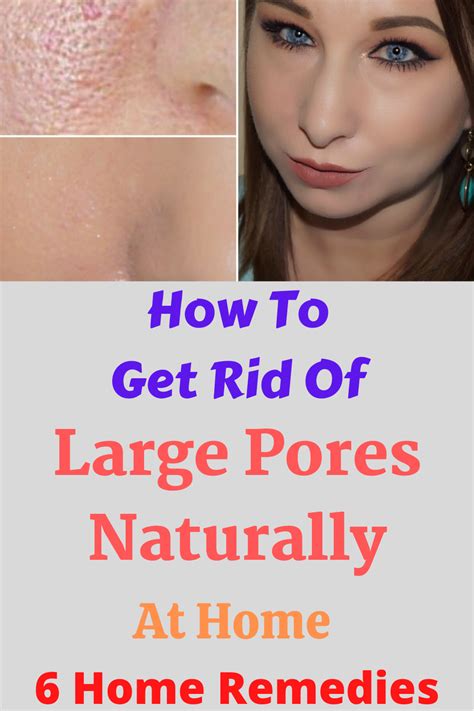 How To Get Rid Of Large Pores Naturally At Home 6 Home Remedies ~ Wedding And Women Life