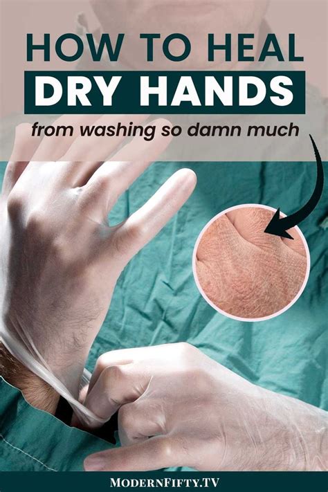 How To Heal Severe Dry Cracked Hands Cracked Hands Dry Cracked