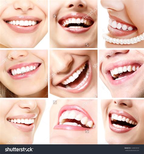 mouths - Google Search | Perfect smile, Teeth health, Smile teeth