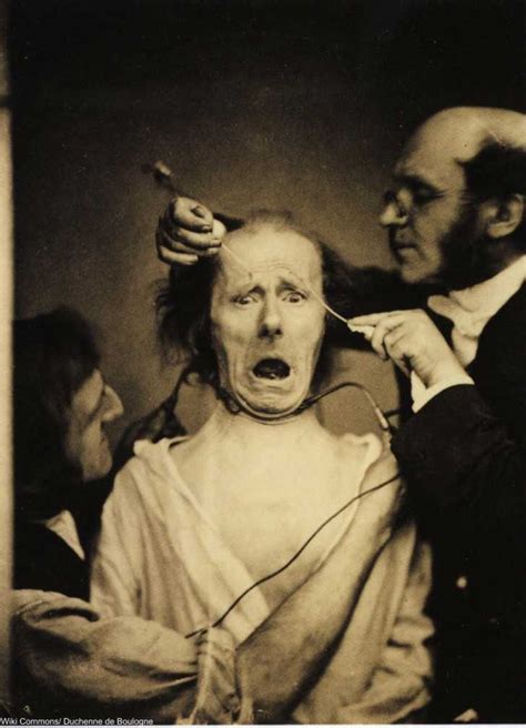 Perfectly Safe 19th Century Human Experiments Produced Horrifying