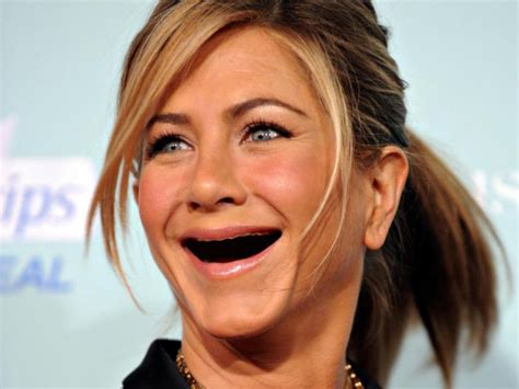 Celebrities With No Teeth 011 Funcage