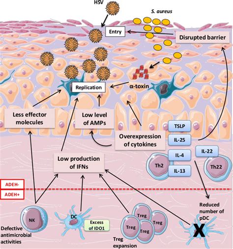 Factors Promoting Hsv Replication In Eczema Herpeticum Atopic
