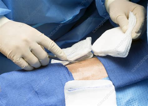 Surgeon Preparing To Make An Incision Stock Image F Science Photo Library