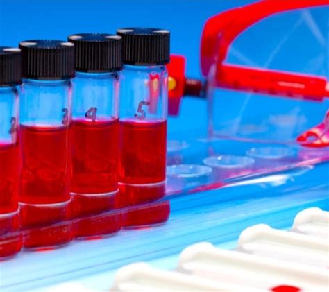 May 17, 2021 · a swab test to check for mold and yeast in the nasal cavities is also done to identify the infection. Fungal Infection Blood Tests