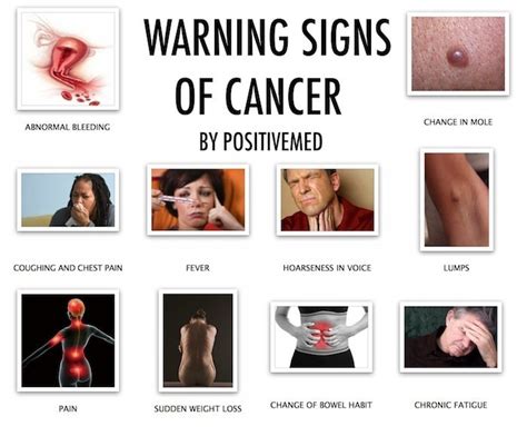 At the existing cancer in the correct colon, generally creating iron deficiency anemia. Warning Signs of Cancer You Don't Want to Ignore