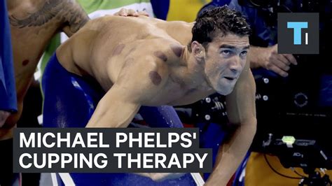 Michael Phelps Cupping Therapy Youtube