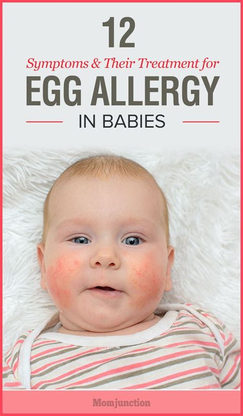 12 Symptoms Of Egg Allergy In Babies And Their Treatment Egg Allergy