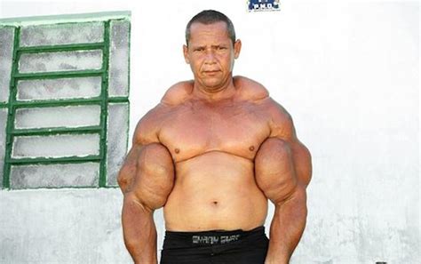 Watch Synthol Freak With Massive Muscles Get Owned By Much