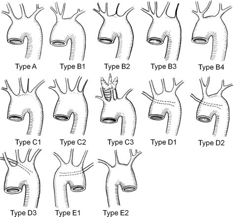 Morphologic Features Of The Aortic Arch And Its Branches In The Adult