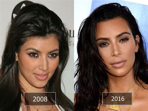 Pictures Of Kim Kardashian Before And After Plastic Surgery