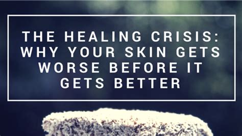 The Healing Crisis Why Your Skin Gets Worse Before It Gets Better