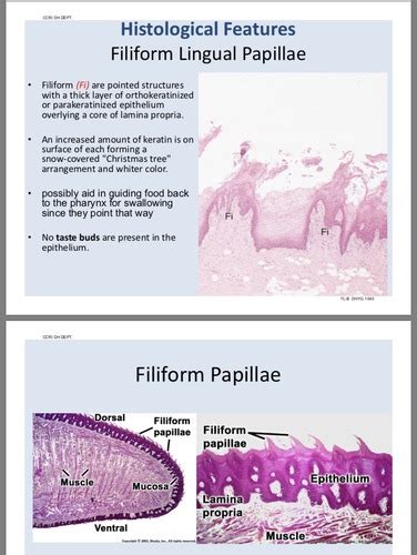 Foliate Papillae Histology