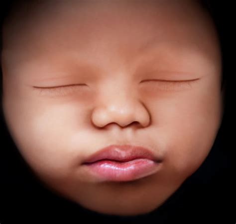 Fetal UltraView Mother Nurture Ultrasound