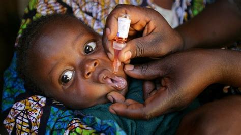 Polio Is Back Who Warns The World Will Face Danger If Polio Re