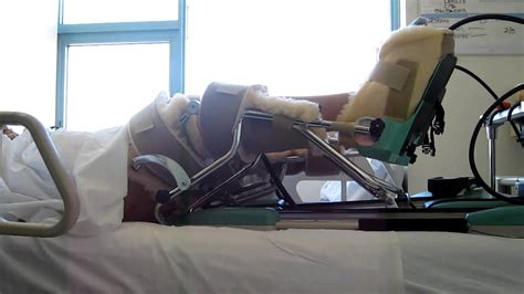 Continuous Passive Motion Movement Machine Bilateral Total Knee Replacement Cpm Youtube