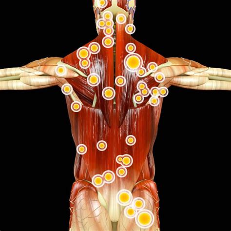 Trigger Point Therapy Olympia Acupuncture Pain Management
