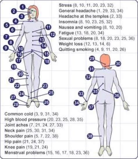 Trigger Points Chart Cupping Therapy Acupuncture Charts Acupressure Treatment
