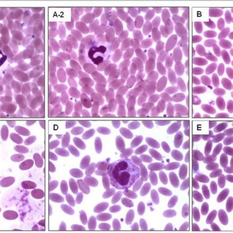 Morphology Of Different Types Of Leukocyte A 1 Segmented Neutrophils